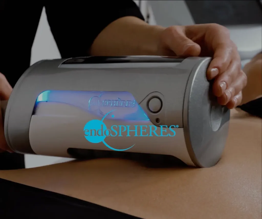 endosferos aparatas kuno formavimui