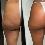 grazesnes kuno linijos