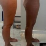 kuno atstatymas po gimdymo